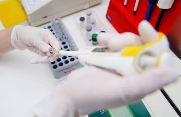 N-Terminal Amino Acid Sequencing for Proteins & Peptides - BOC Sciences