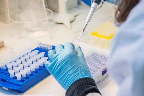 N-Terminal Amino Acid Sequencing for Proteins & Peptides - BOC Sciences
