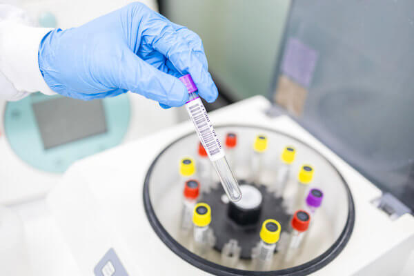 N-Terminal Amino Acid Sequencing for Proteins & Peptides - BOC Sciences